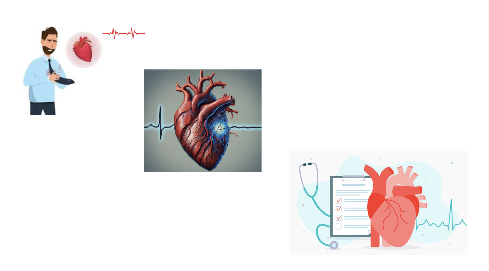 Arrhythmia Detection